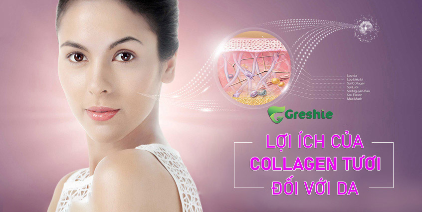 Loi ich cua Collagen tuoi