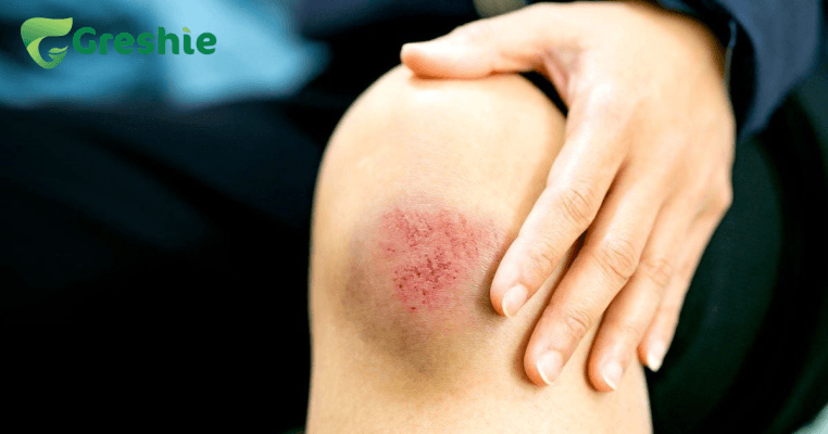 Thiet ke chua co ten