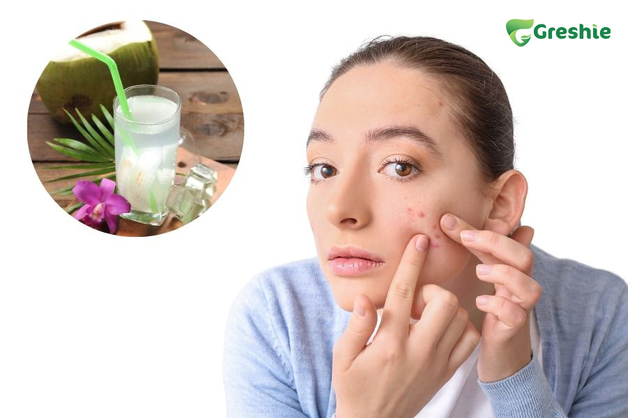 bi mun co nen uong nuoc dua