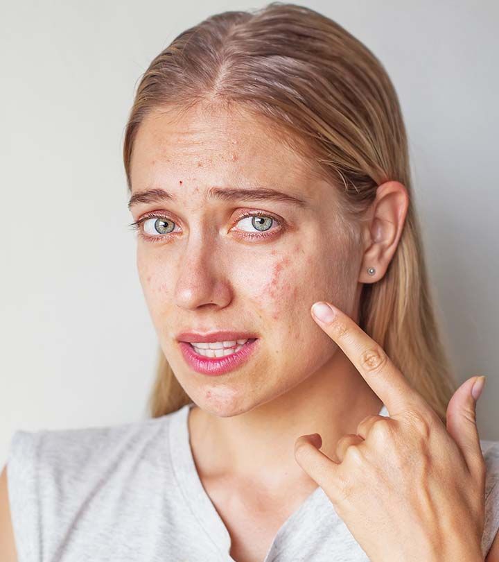 Collagen Giúp Phục Hồi Da Tổn Thương: Cách Uống Để Duy Trì Làn Da Trẻ Đẹp Uống collagen