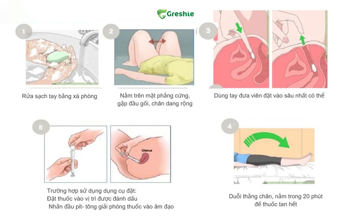 Cach Su Dung Dung Cu Dat Thuoc Phu Khoa Dung Cach