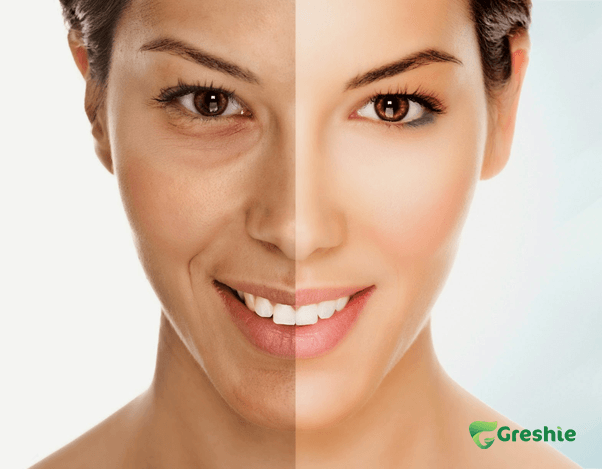 Chong Lao Hoa va Tai Tao Da