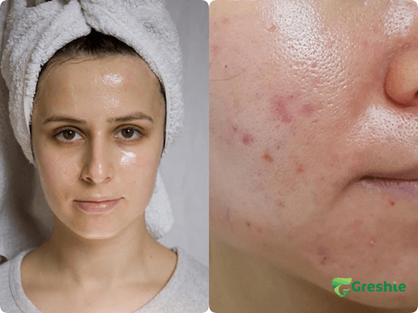 Cung Cap Do Am Cho Da