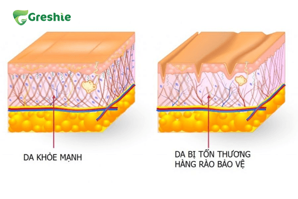 Lam diu va phuc hoi da ton thuong