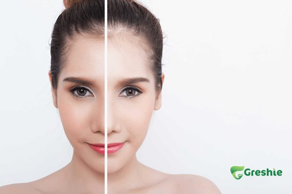 Lam trang da Qua trinh va co che hoat dong