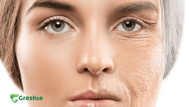 Ly do nen uong collagen trong mua dong Ngan ngua lao hoa da