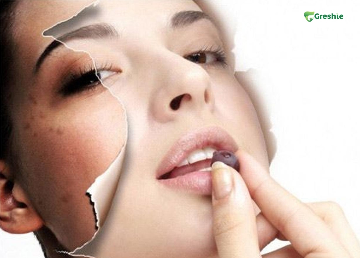 Rui Ro Tiem An Khi Su Dung Collagen