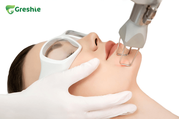 Su dung tia laser tac dong vao lop ha bi cua da