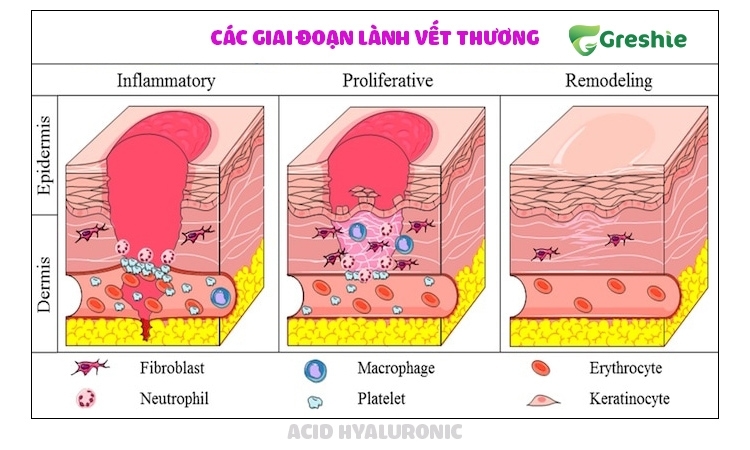 Thuc day chua lanh vet thuong