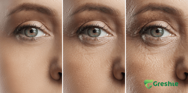 Tuoi cang cao kha nang hap thu collagen cang giam