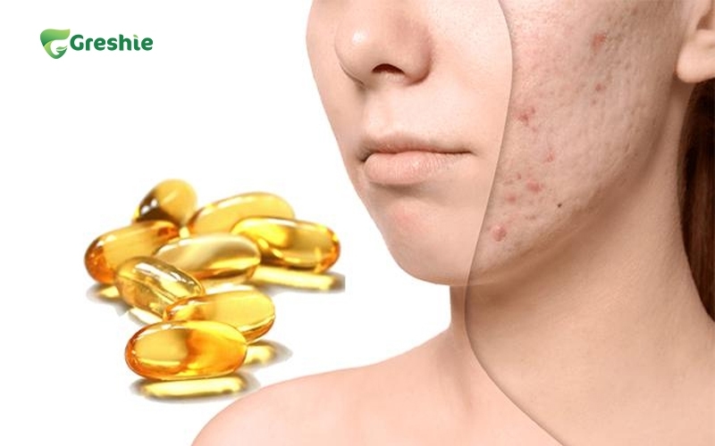 Vitamin E Ho Tro Lam Lanh Seo va Tham