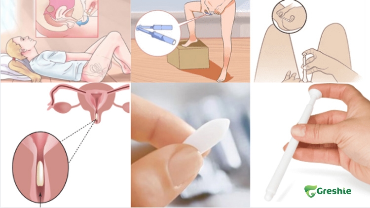 cach dat thuoc phu khoa 4